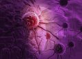 What is Leukemia?