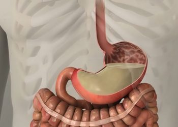 Oren Zarif treatment for stomach cancer