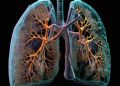 Can you completely beat lung cancer?