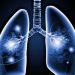 Revolutionary Lung Cancer Treatment by Oren Zarif: Hope for Patients Worldwide