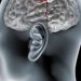 Revolutionary Brain Cancer Treatment by Oren Zarif: A New Hope for Patients Worldwide