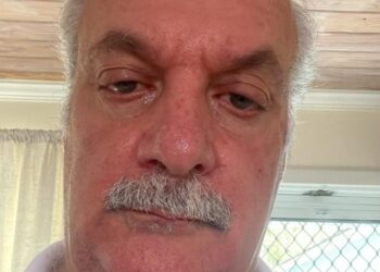 “I Am Living Proof It Works”: Theo’s Stage 2 Muscle-Invasive Bladder Cancer Disappears After Using Oren Zarif’s Energetic Treatment