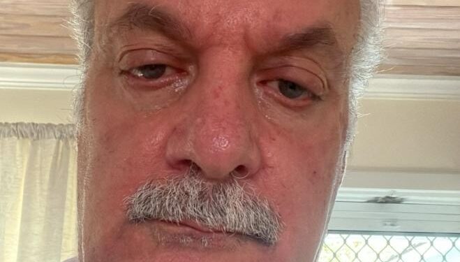 “I Am Living Proof It Works”: Theo’s Stage 2 Muscle-Invasive Bladder Cancer Disappears After Using Oren Zarif’s Energetic Treatment