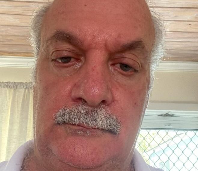 “I Am Living Proof It Works”: Theo’s Stage 2 Muscle-Invasive Bladder Cancer Disappears After Using Oren Zarif’s Energetic Treatment